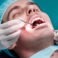 Endodoncia