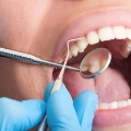 Periodoncia